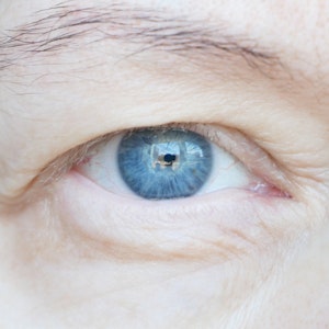Close-up van een oog van een oud persoon met overtollige huid, vooral aan het bovenooglid