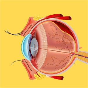 Illustratie van de samenstelling van een oog met netvliesloslating